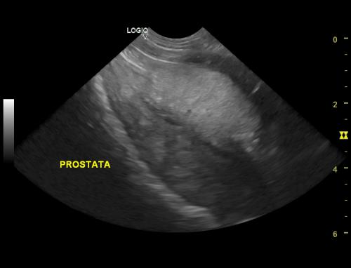 prostata